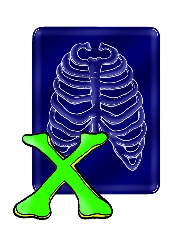 x
